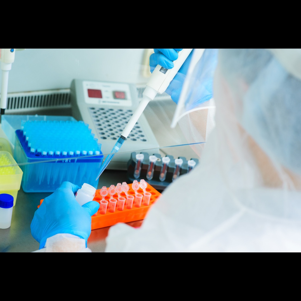 AGT 2  C4072T  SNPsize:Screen RTsize:PCR test for detection of Angiotensinogen mutation 2  Met235Thr, rs699  ready to use 0,2 ml tube format