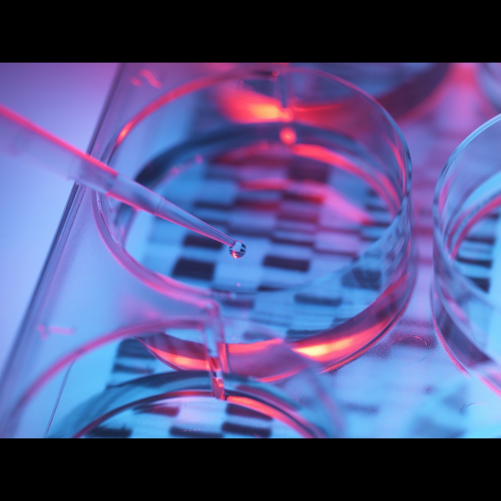 Amplirun® Herpes Simplex 1 DNA Control size: 10,000size:20,000 c/µL