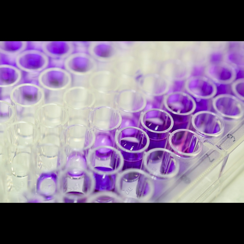 CAF elisa kit : Human CAF  csize:terminal fragment of agrin  ELISA Kit size: 96 Wells